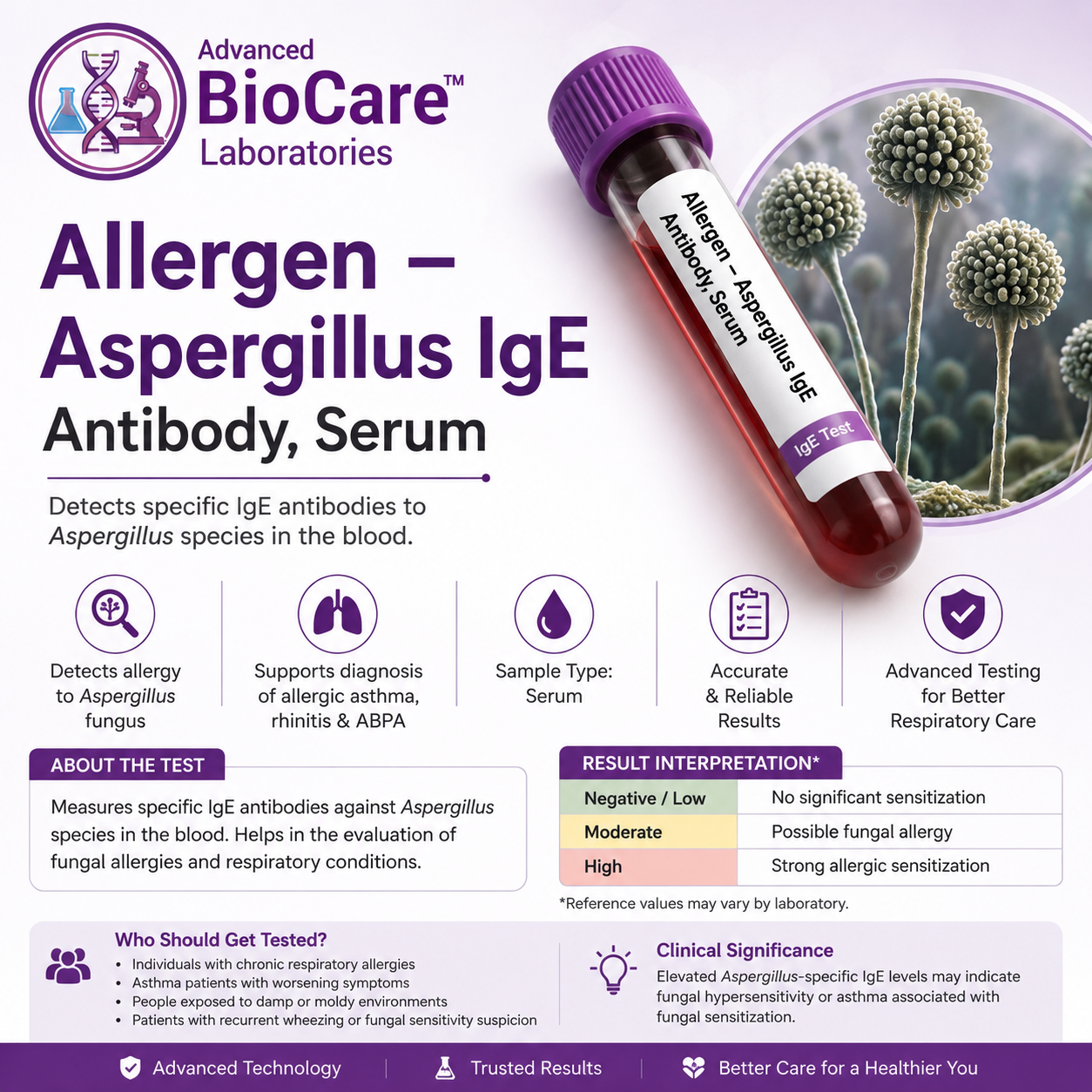 Allergen - Aspergillus IgE Antibody, Serum