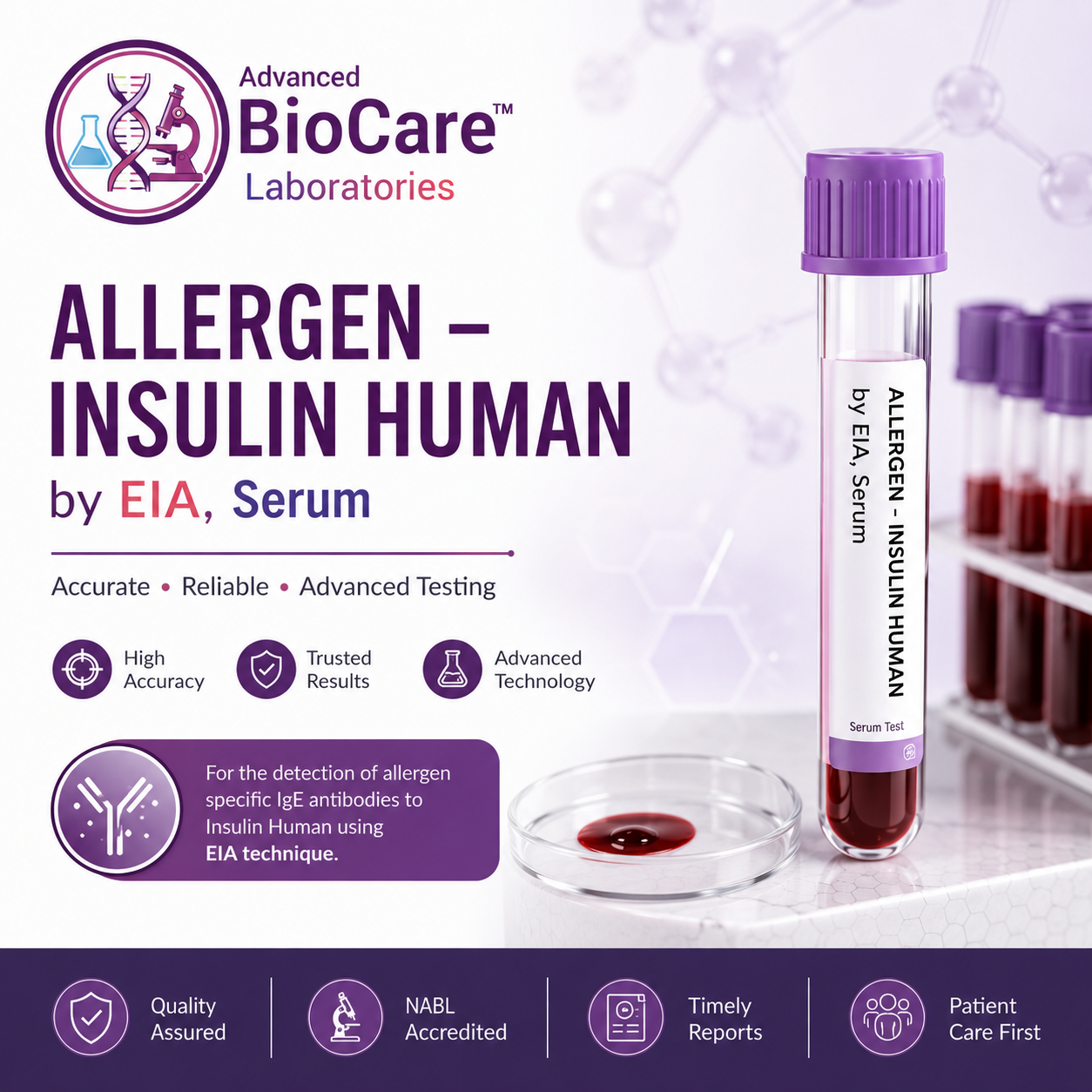 Allergen - INSULIN HUMAN by EIA, Serum
