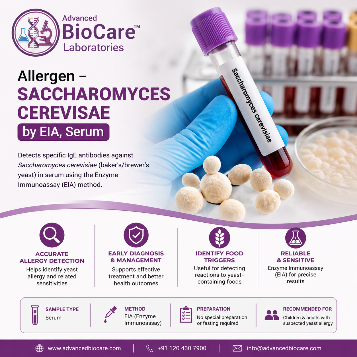 Allergen - SACCHAROMYCES CEREVISAE by EIA, Serum