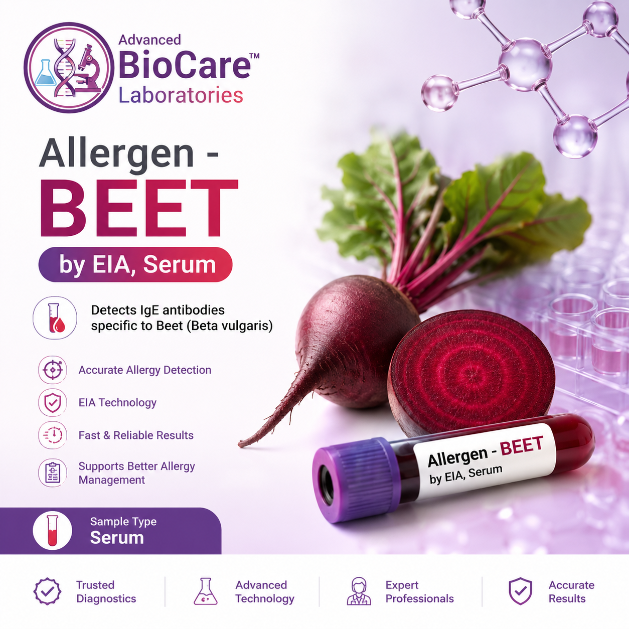 Allergen - BEET by EIA, Serum