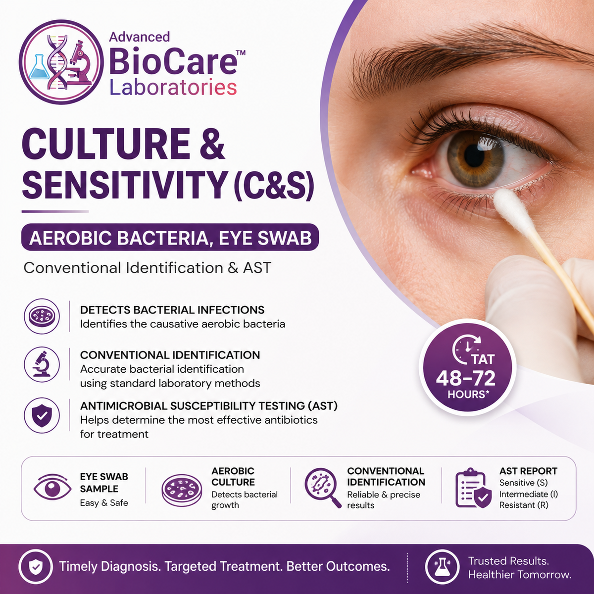 Culture & Sensitivity, Aerobic bacteria, Eye swab, Conventional Identification & AST