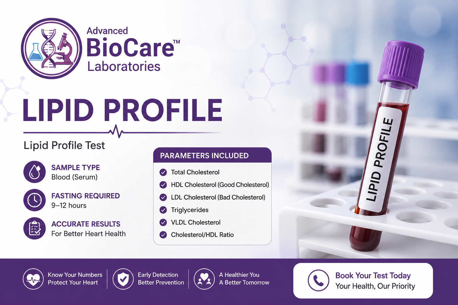 LIPID PROFILE
