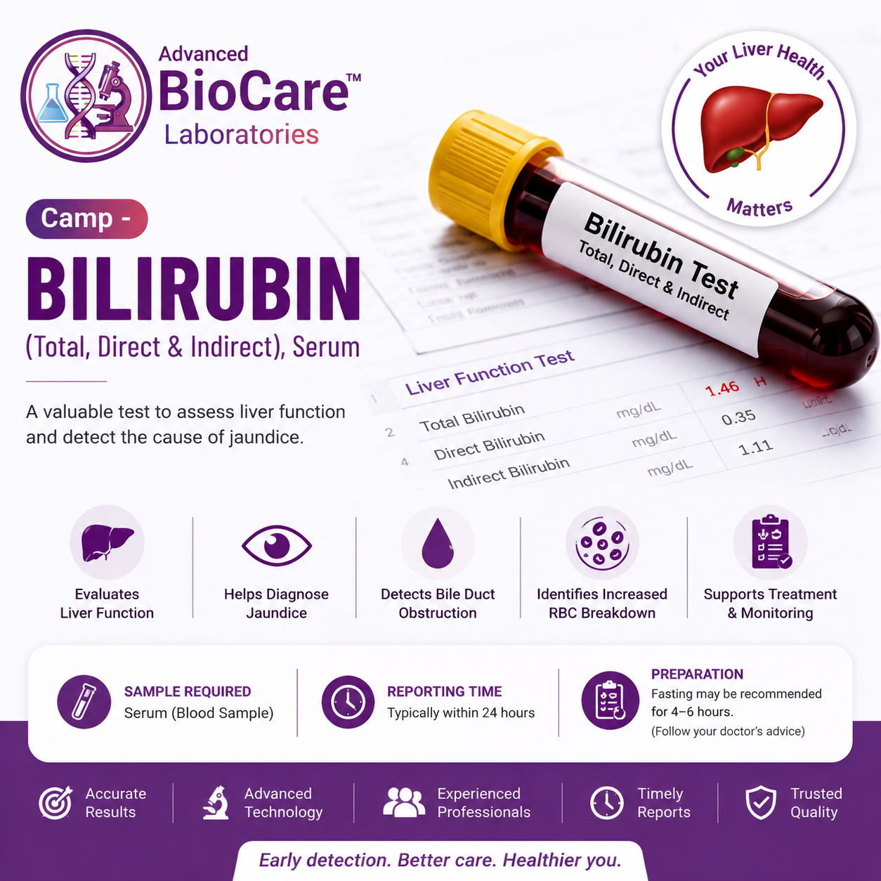 Bilirubin (Total, Direct & Indirect), Serum