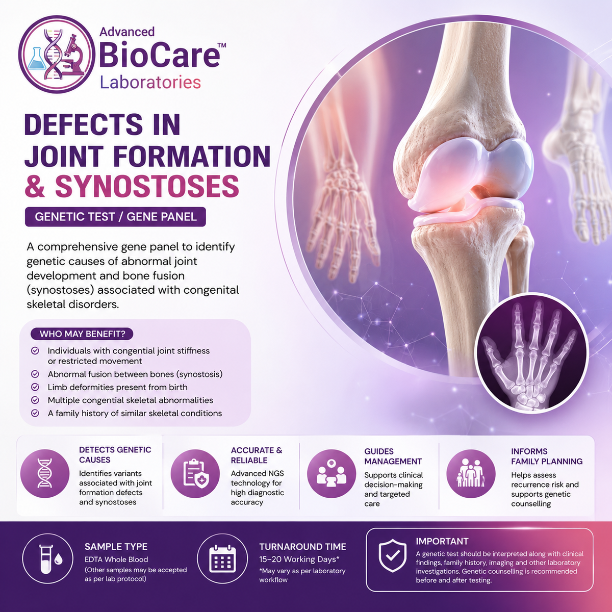Defects in joint formation & synostoses