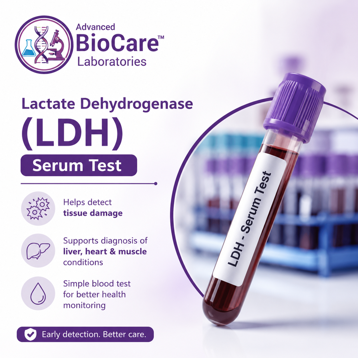 Lactate dehydragenase (LDH), Serum