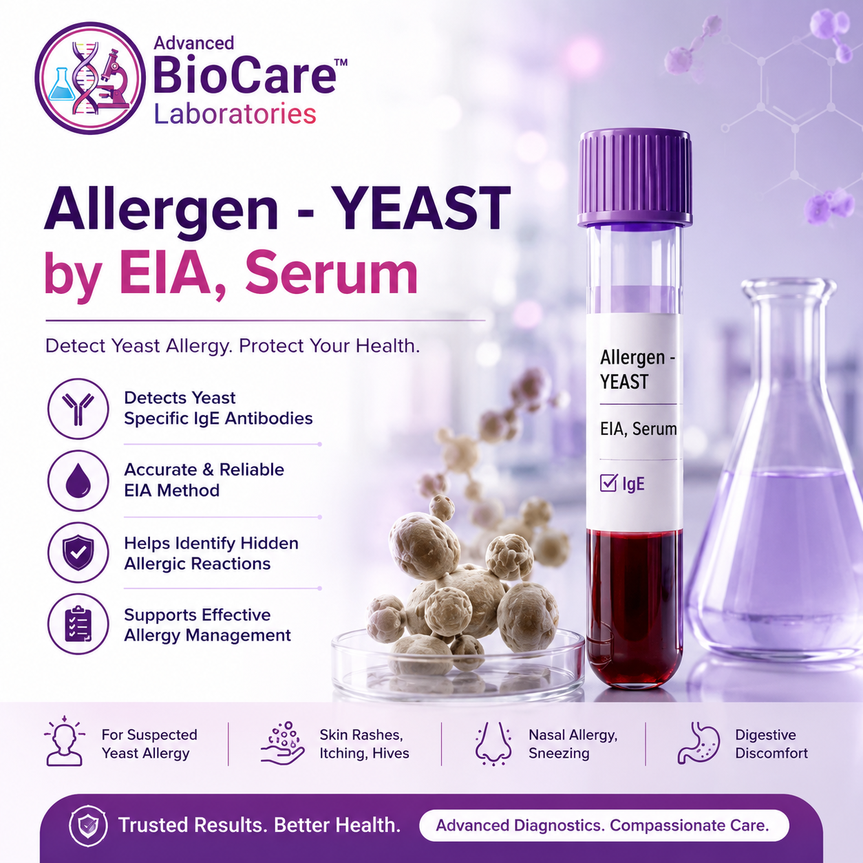 Allergen - YEAST by EIA, Serum