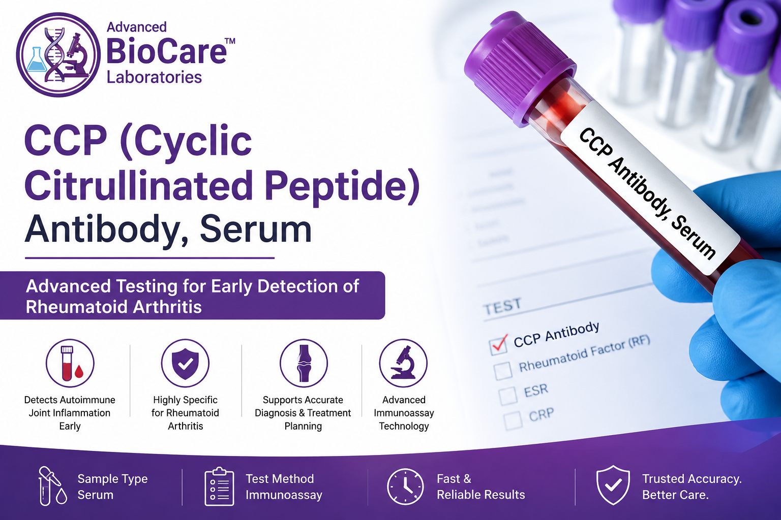 CCP (Cyclic Citrullinated Peptide) Antibody, Serum