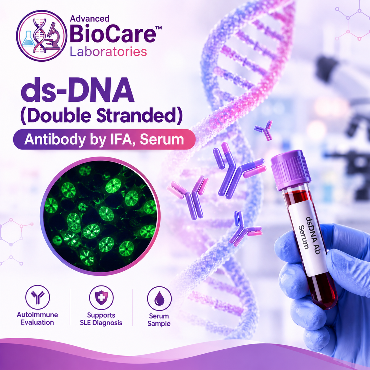 ds-DNA (Double stranded) - Antibody by IFA, Serum