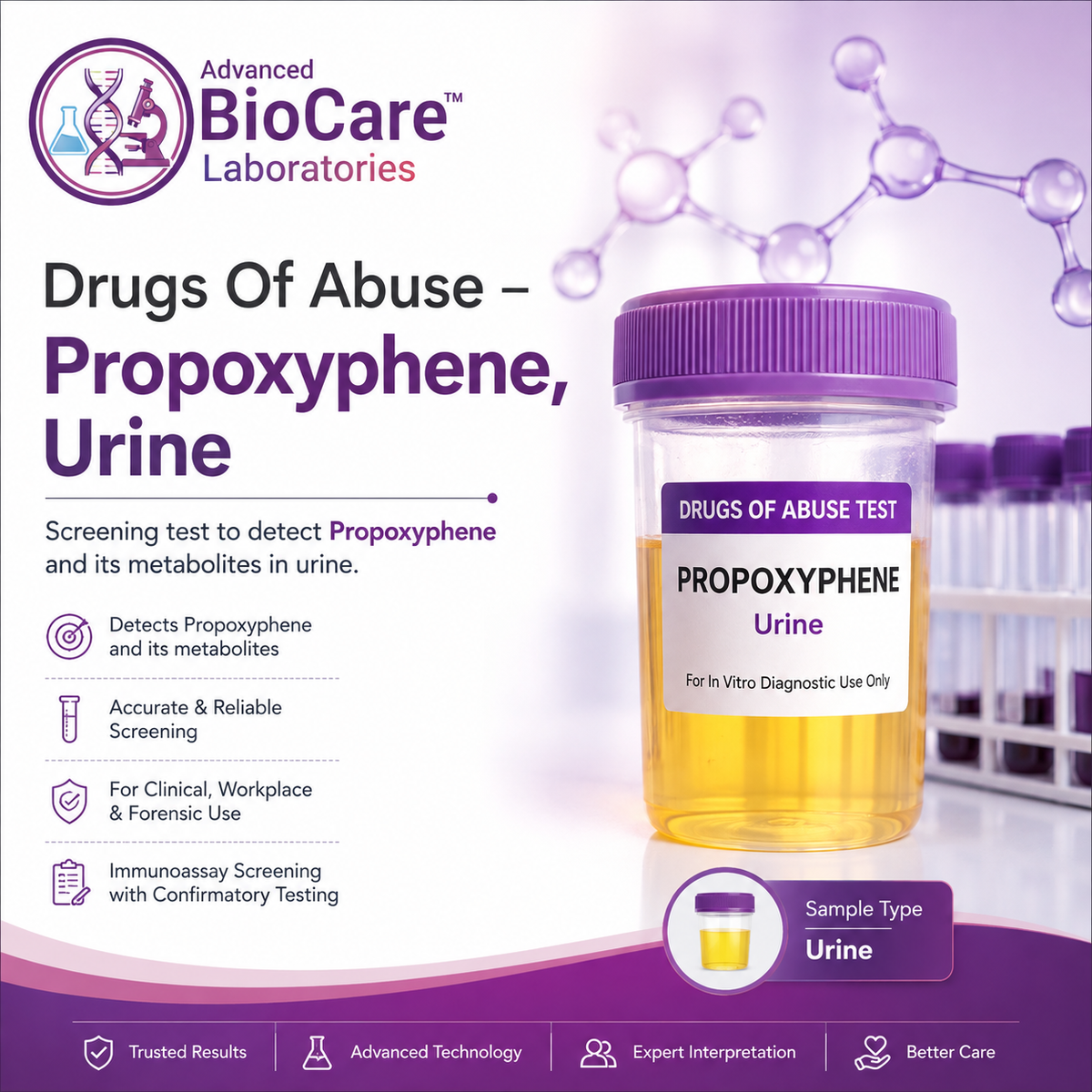 Drugs Of Abuse - Propoxyphene, Urine