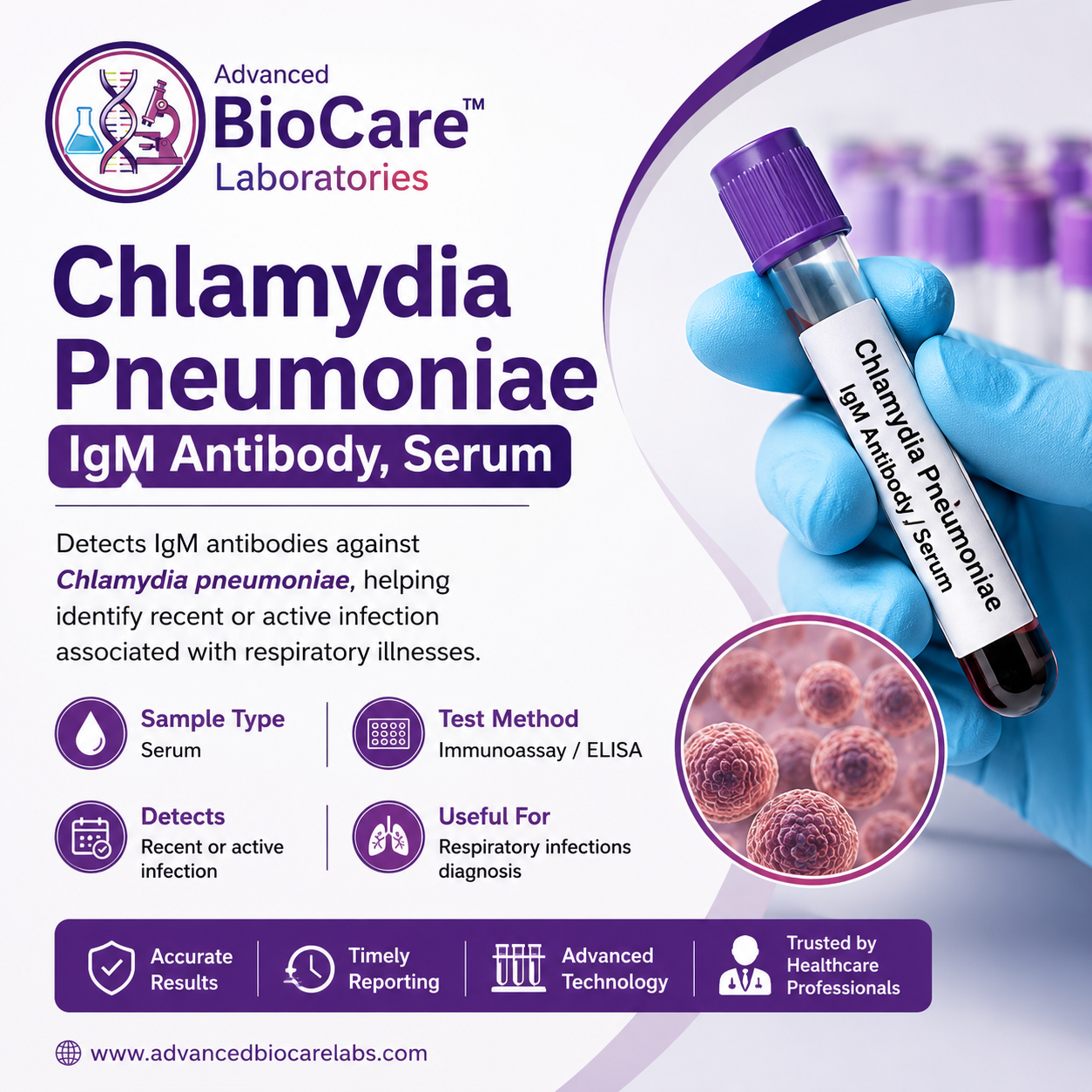 Chlamydia PneumoniaeIgM Antibody Serum