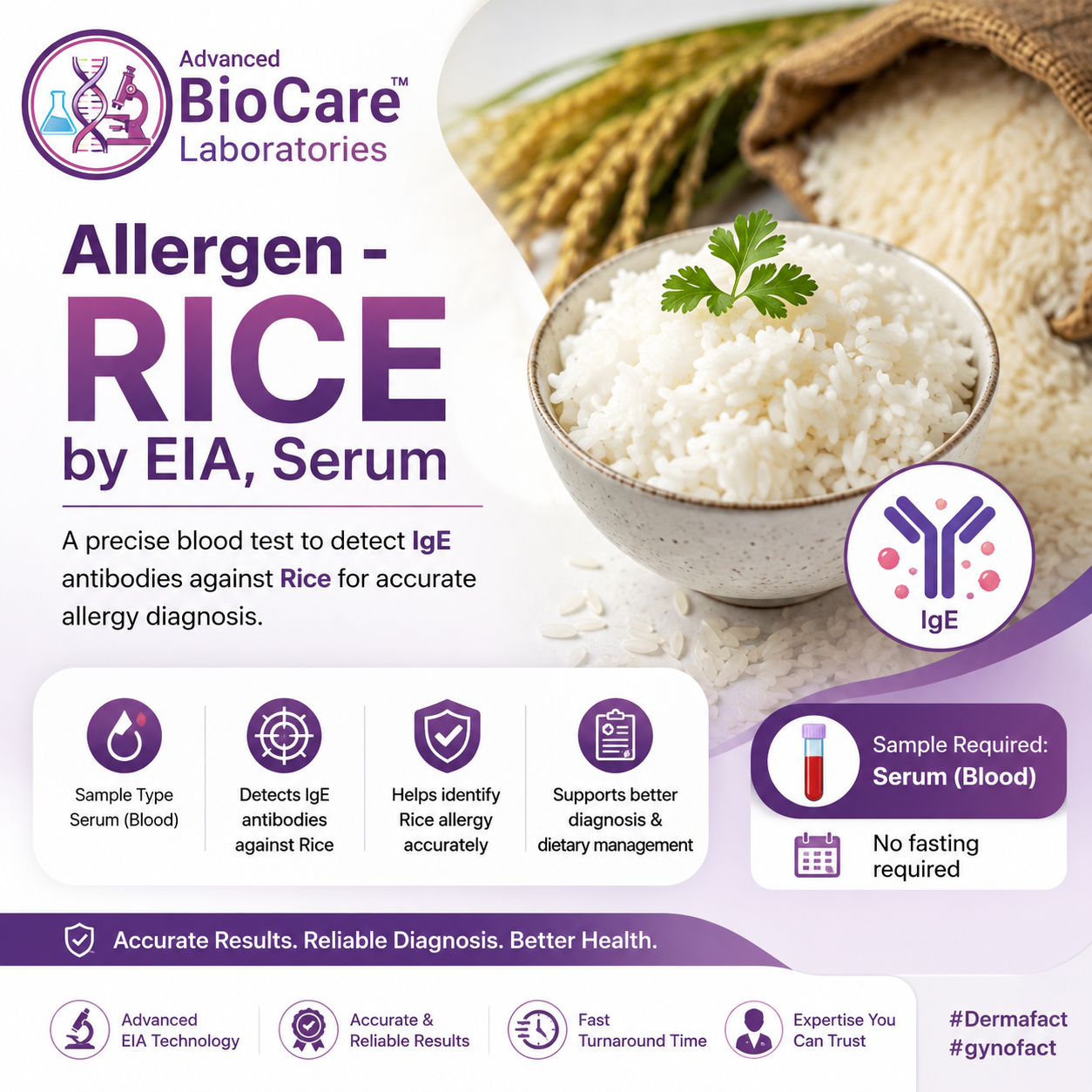 Allergen - RICE by EIA, Serum