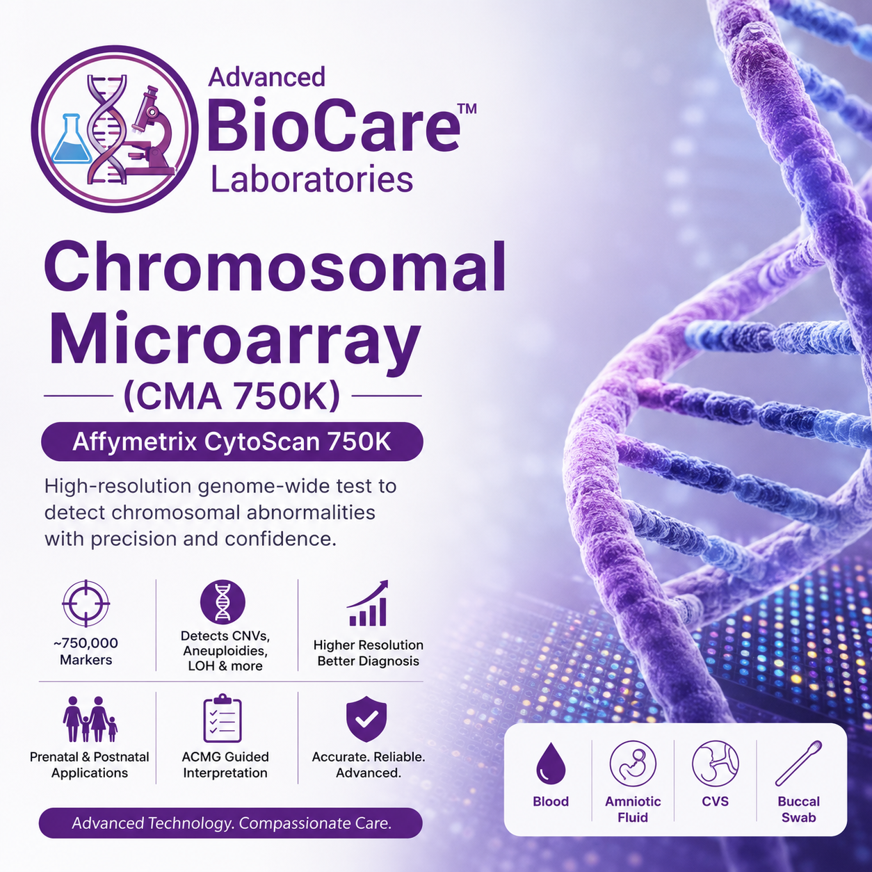 Chromosomal  Microarray(CMA 750 K) -  Affymetrix  Cytoscan 750K
