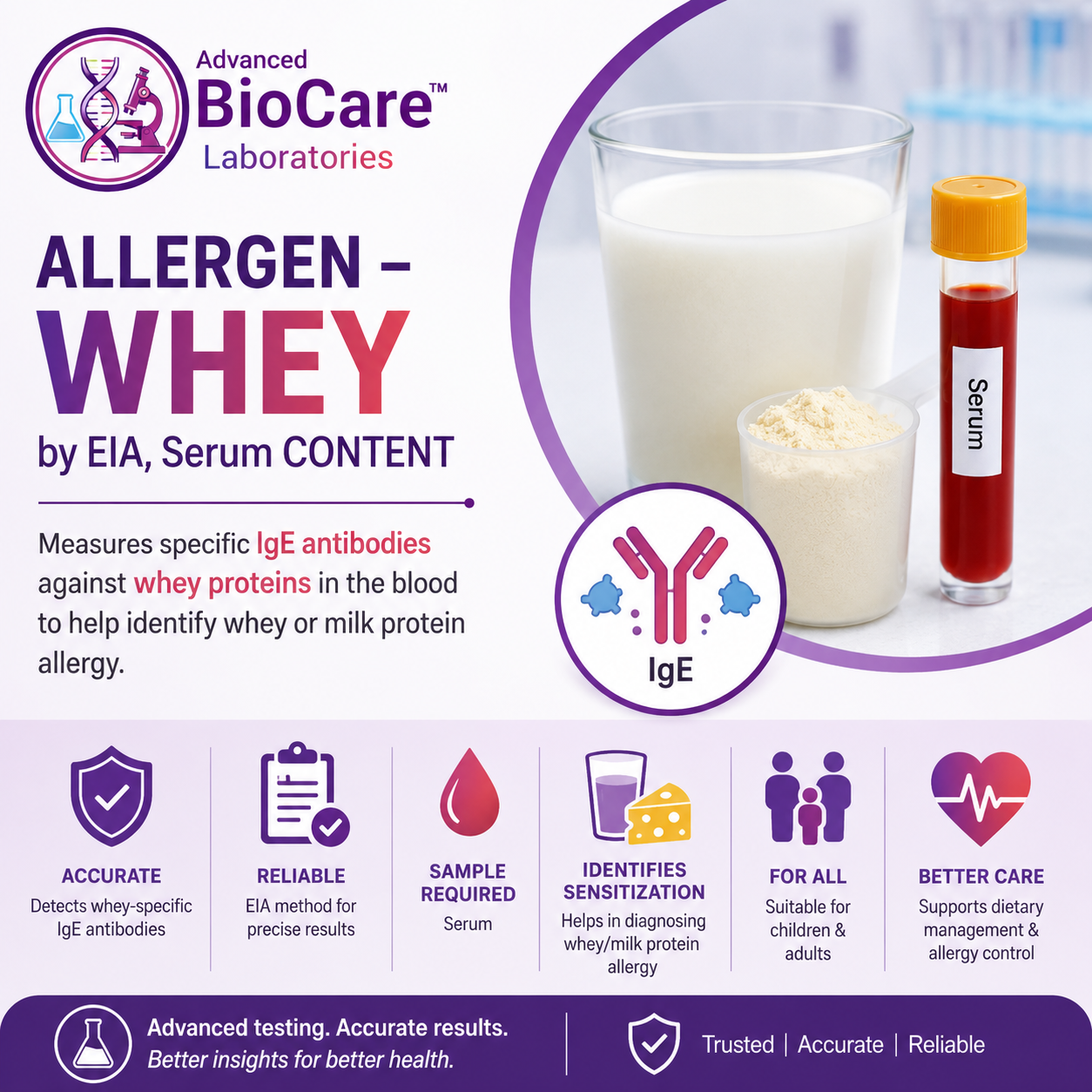 Allergen - WHEY by EIA, Serum