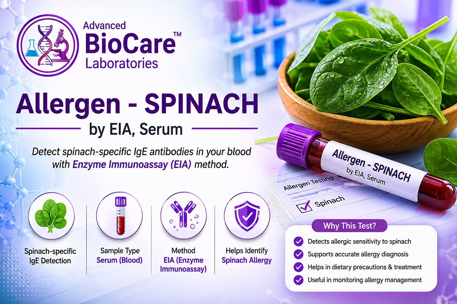 Allergen - SPINACH by EIA, Serum