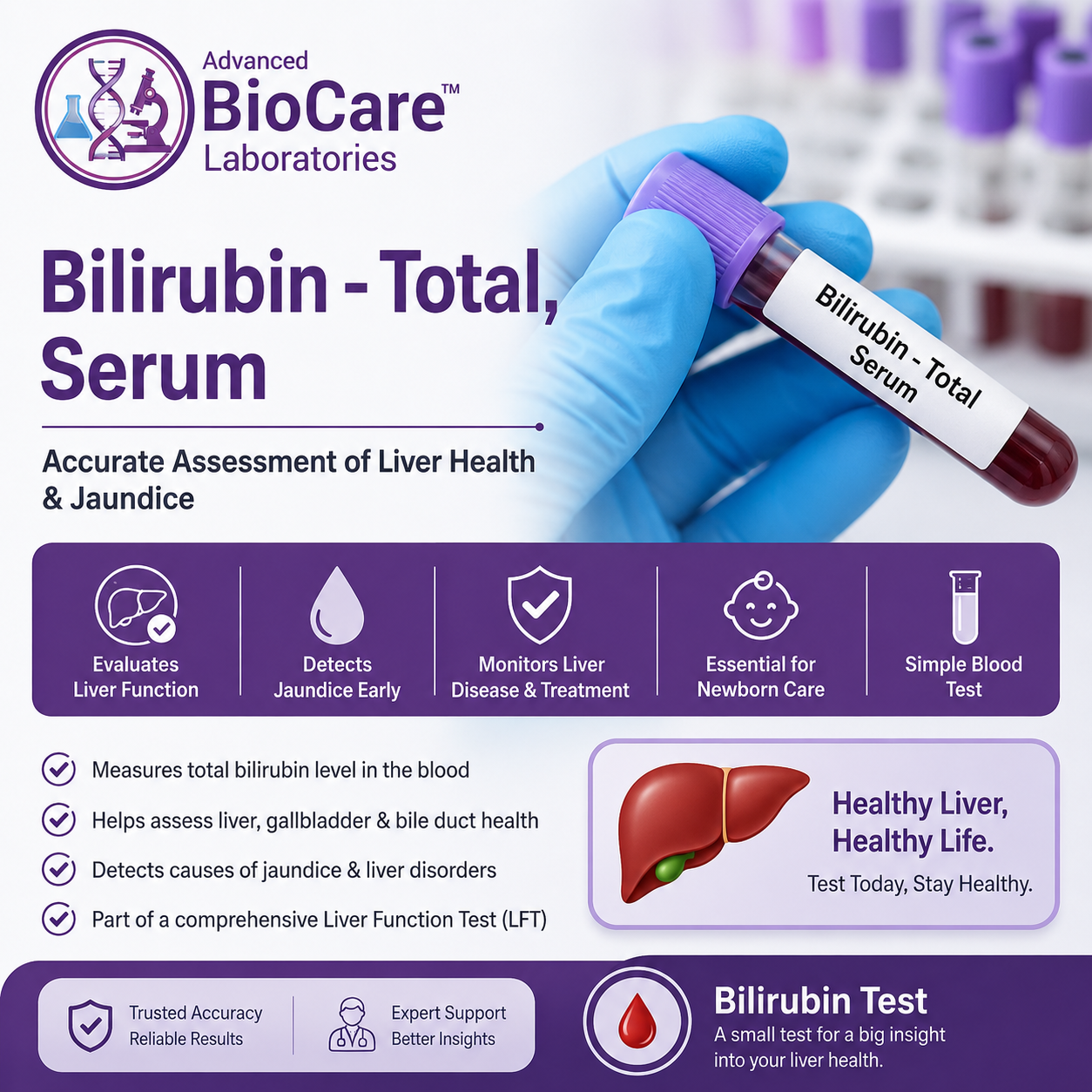 Bilirubin - Total, Serum
