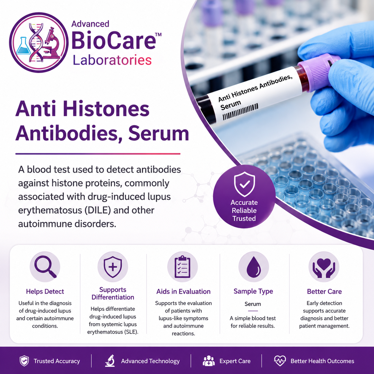 Anti Histones Antibodies, Serum