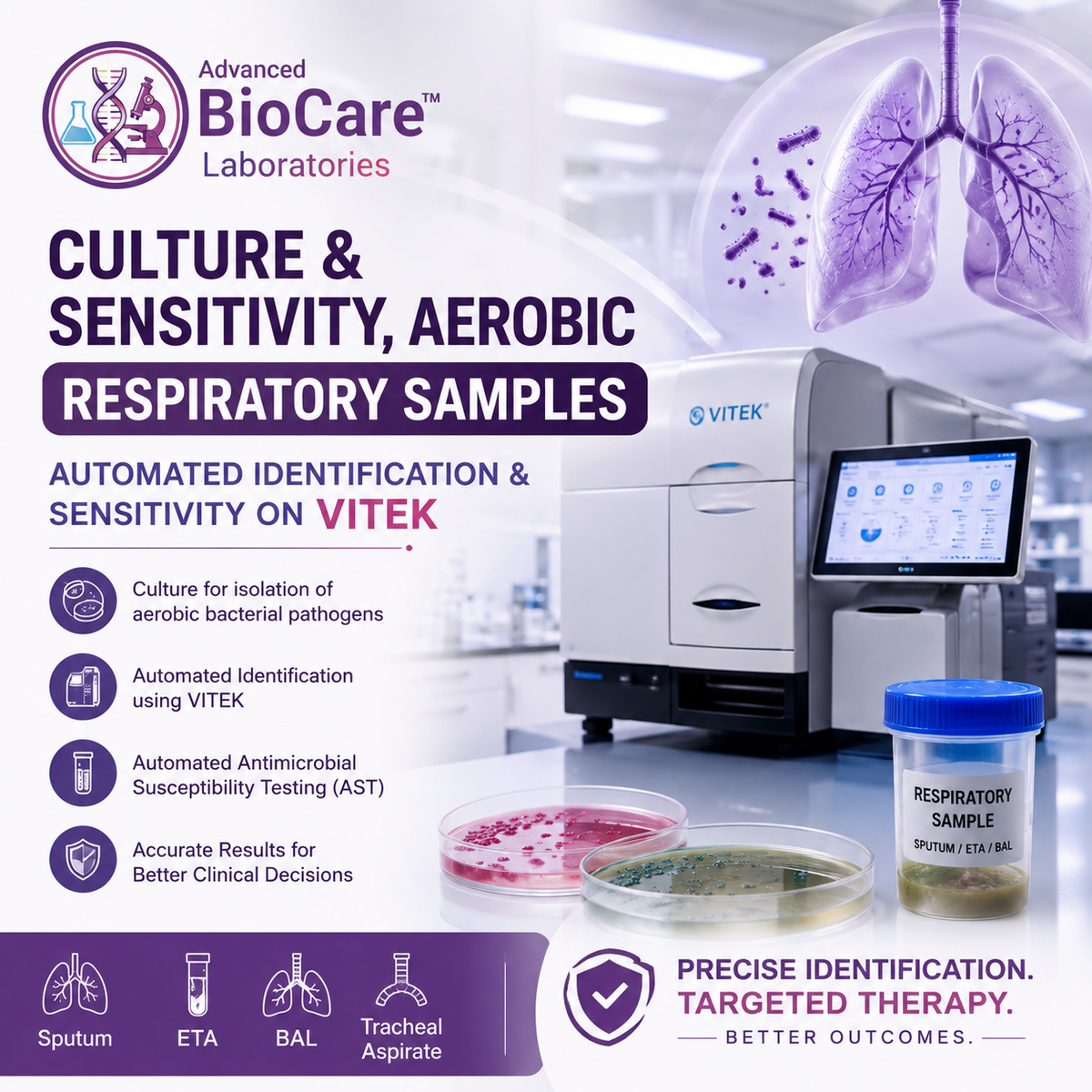 Culture & Sensitivity, Aerobic, Respiratory samples- Automated Identification & Sensitivity on Vitek