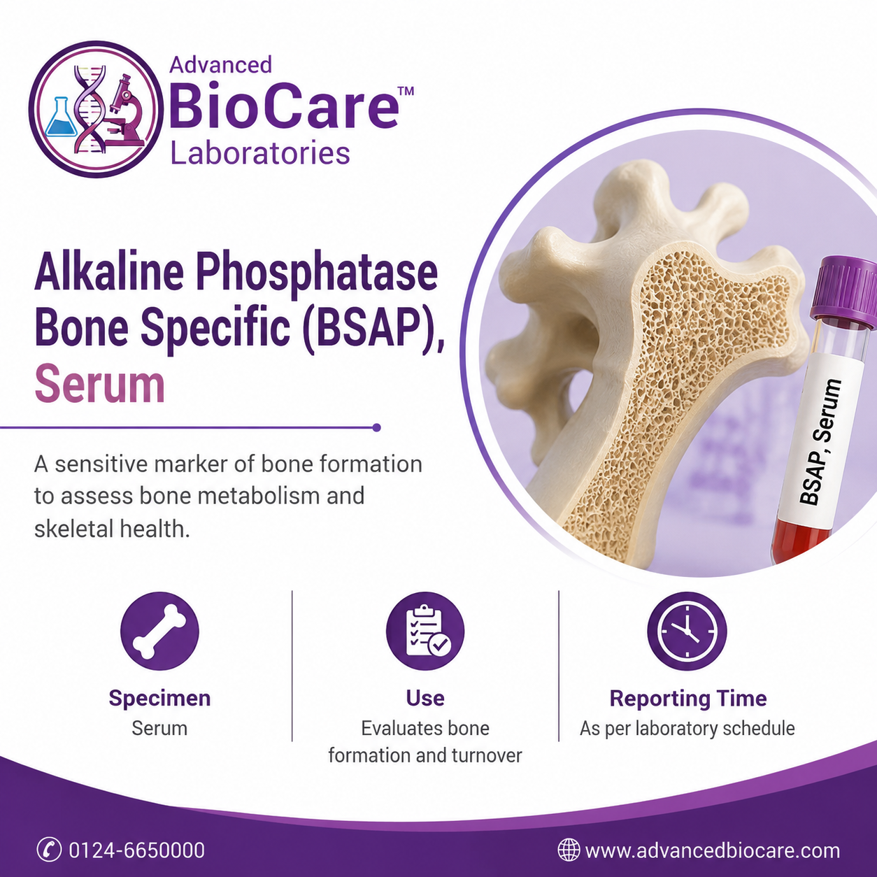 Alkaline Phosphatase Bone Specific (BSAP), Serum
