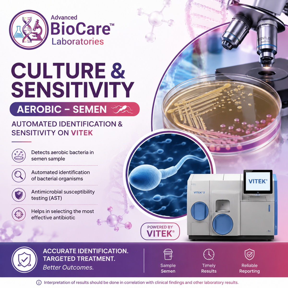 Culture & Sensitivity, Aerobic, Semen- Automated Identification & Sensitivity on Vitek