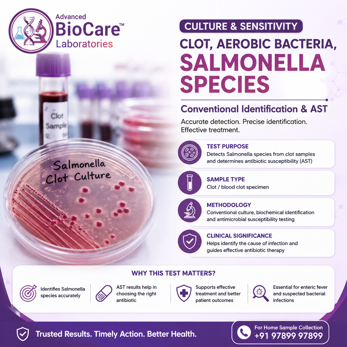 Culture Clot, Aerobic bacteria, Salmonella Species, Conventional Identification & AST