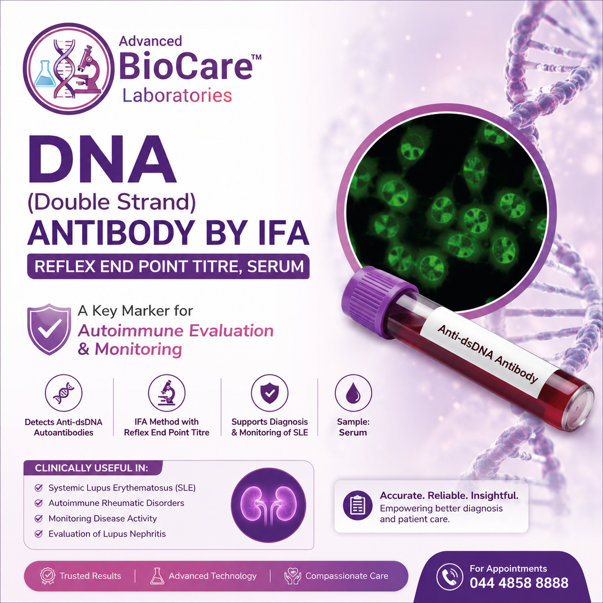 DNA (Double Strand) Antibody By IFA - Reflex end point titre, Serum