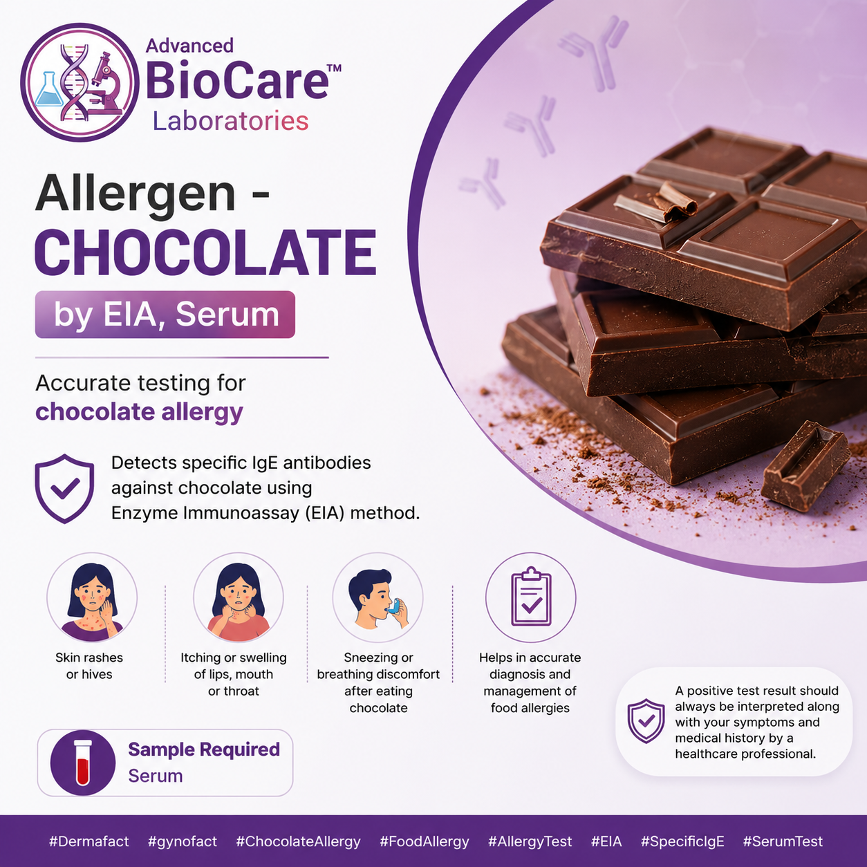 Allergen - CHOCOLATE by EIA, Serum
