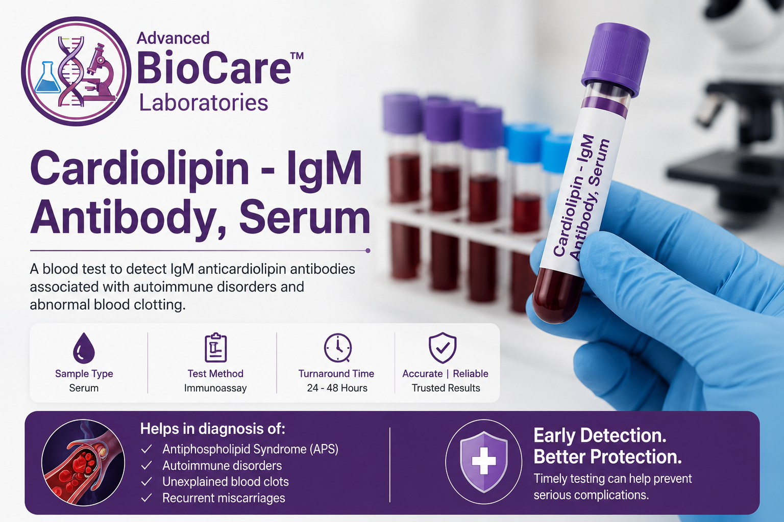 Cardiolipin - IgM Antibody, Serum