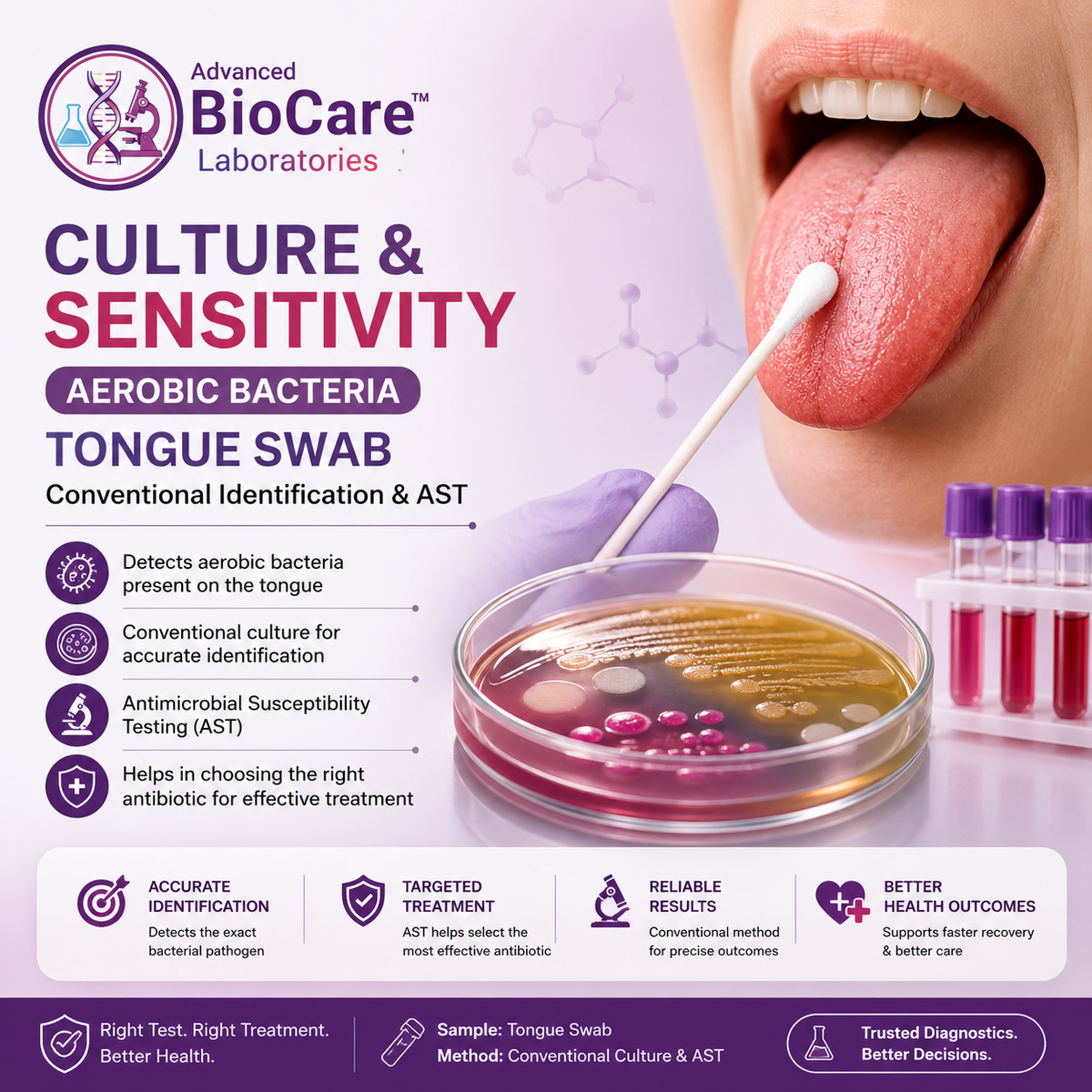 Culture & Sensitivity, Aerobic bacteria, Tongue swab, Conventional Identification & AST