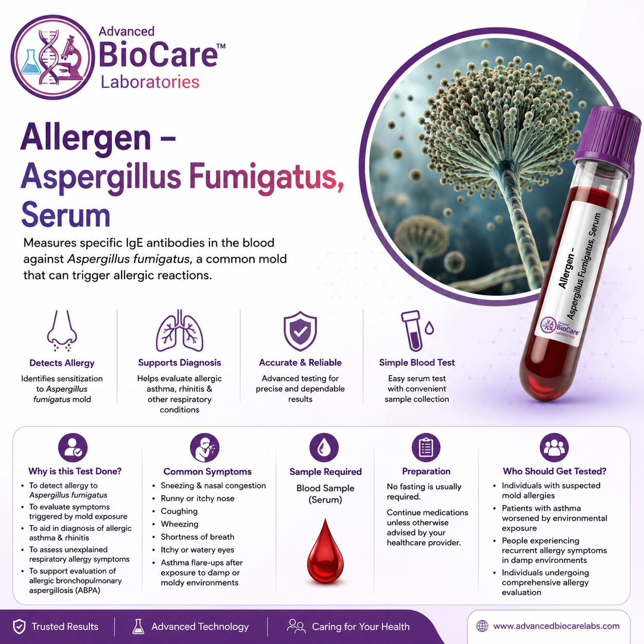 Allergen - ASPERGILLUS FUMIGATUS by EIA, Serum