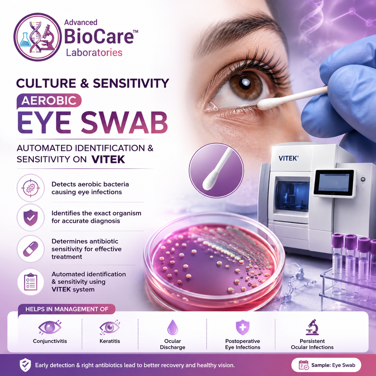 Culture & Sensitivity, Aerobic, Eye swab- Automated Identification & Sensitivity on Vitek