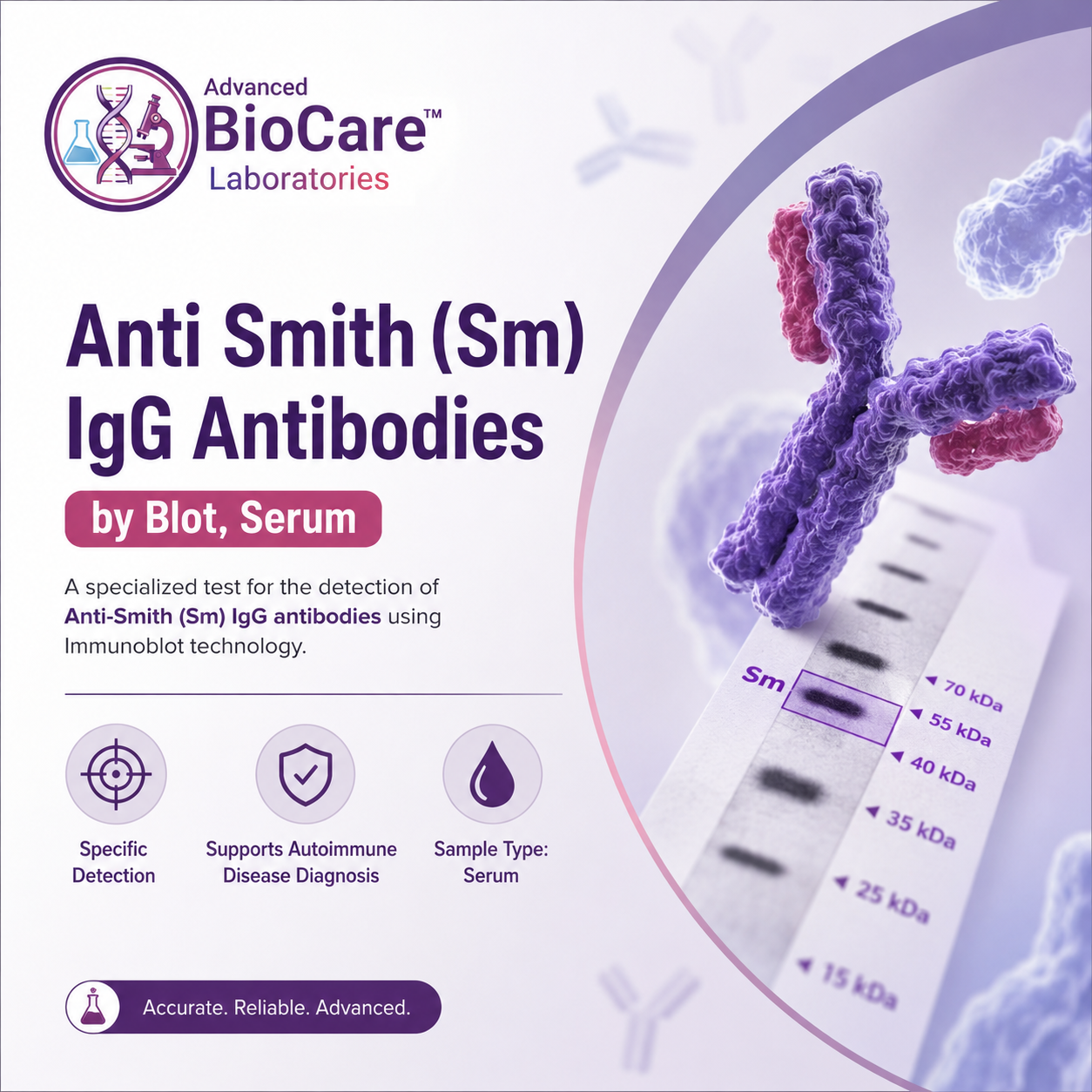 Anti Smith (SM) IgG Antibodies by blot, Serum