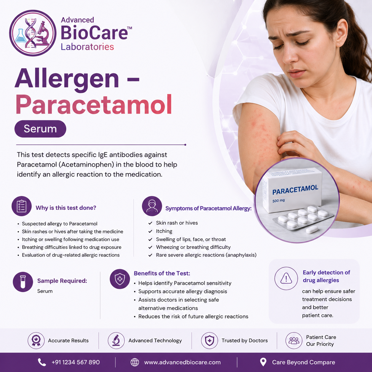 Allergen - PARACETAMOL by EIA, Serum