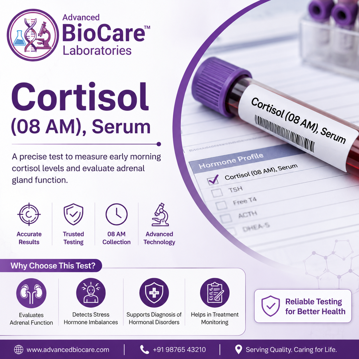 Cortisol