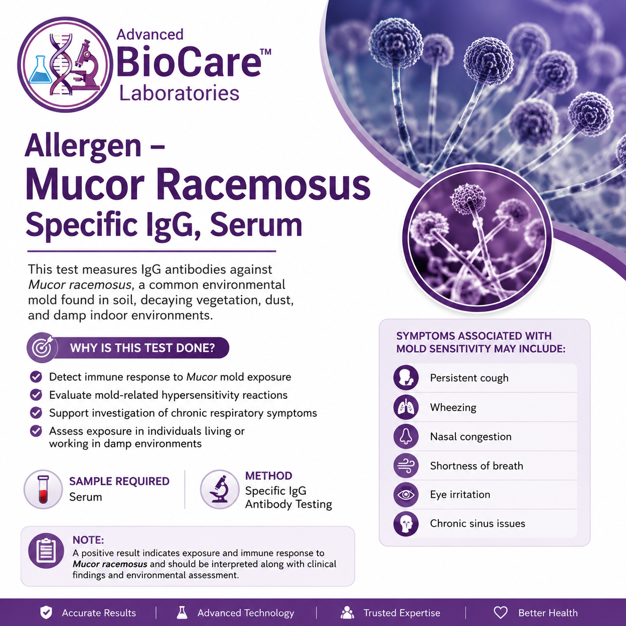 Mucor Racemosus Specific IgG, Serum