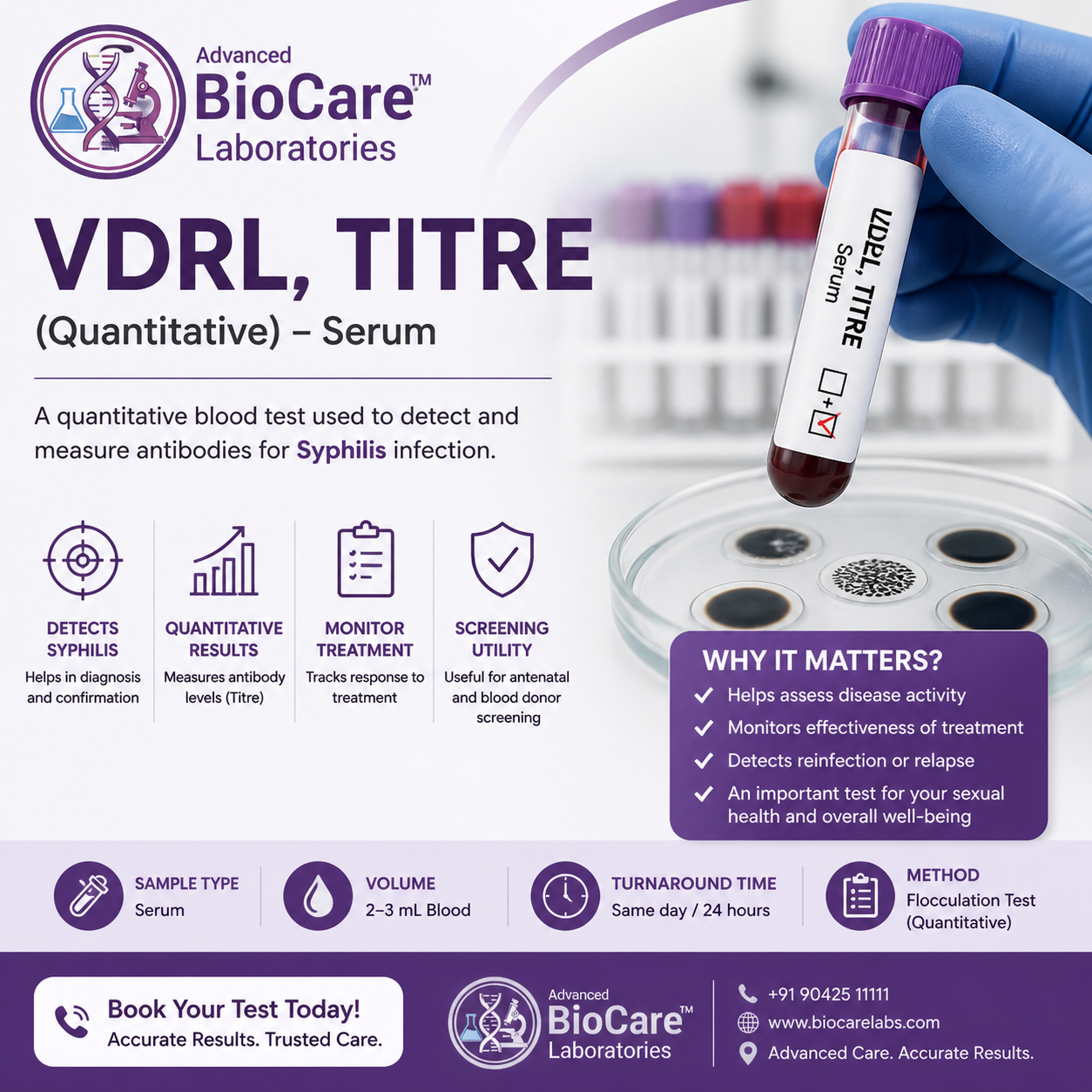 VDRL(RPR), Flocculation,Titer,CSF