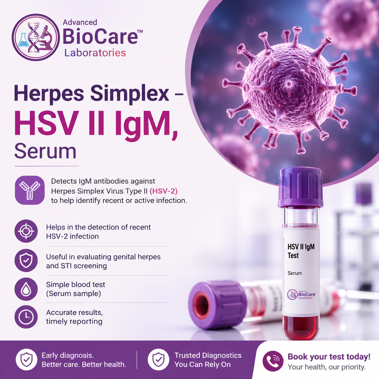 Herpes Simplex - HSV II IgM, Serum