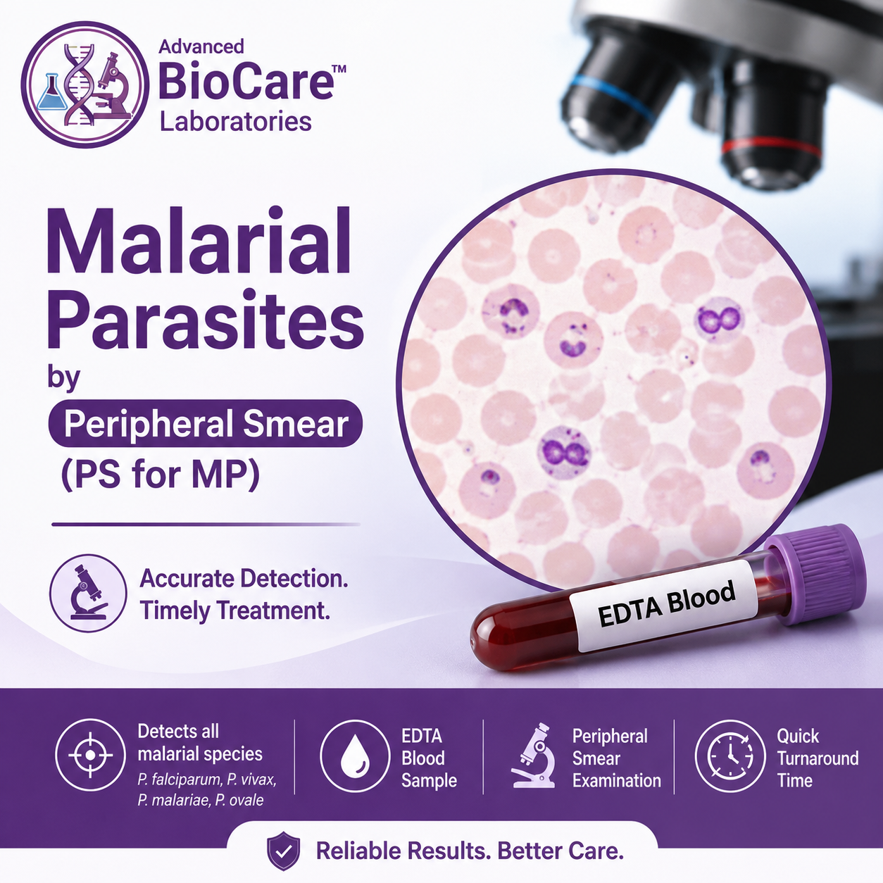 Malarial Parasites by Peripheral Smear (PS for MP), EDTA Blood