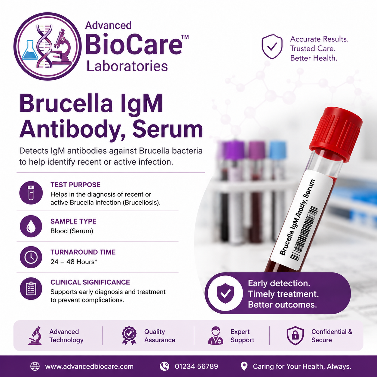 Brucella IgM Antibody, Serum