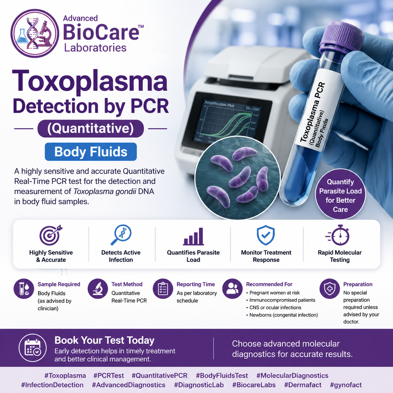 Toxoplasma Detection by PCR (Quantitative), Body Fluids