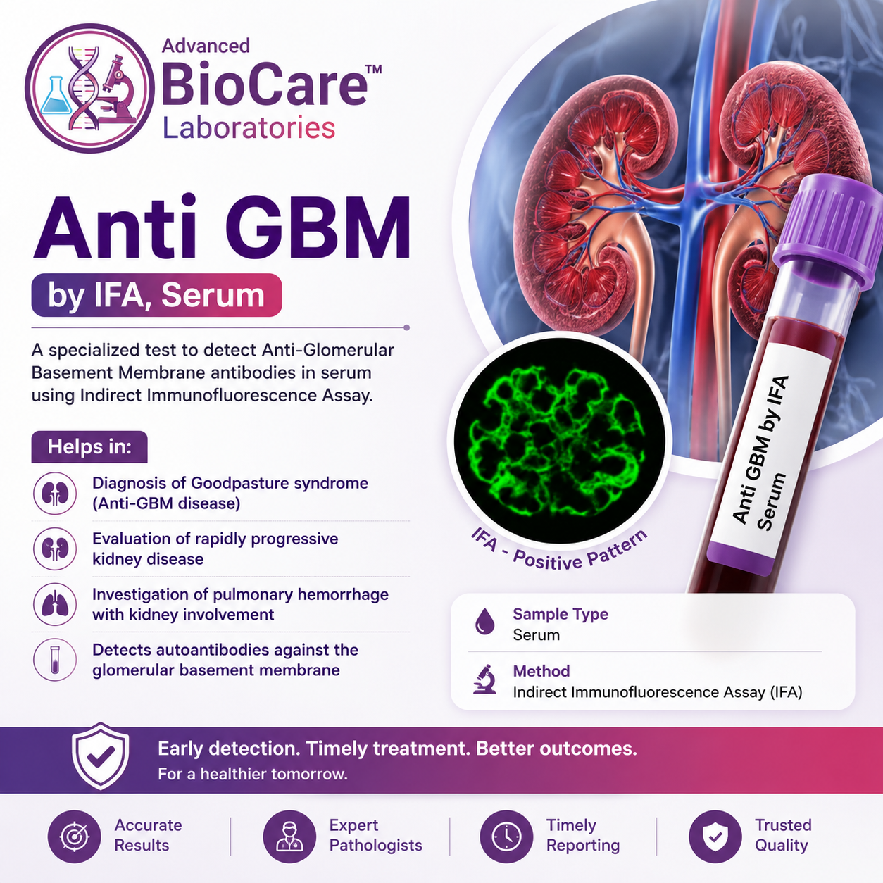 Anti GBM by IFA, Serum