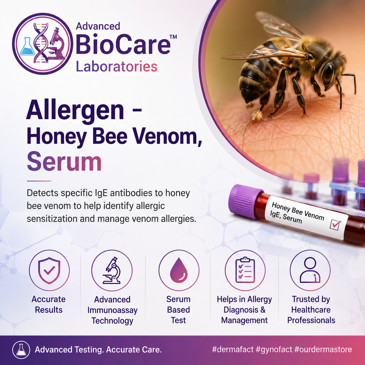Allergen - Honey Bee Venom, Serum