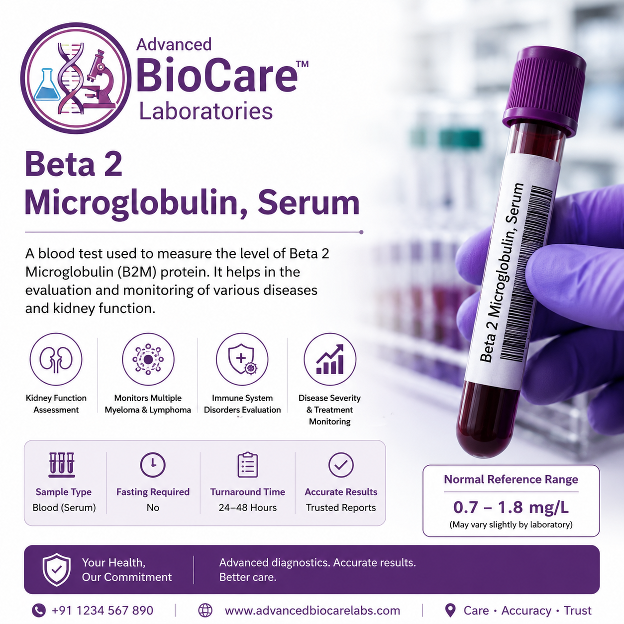 Beta-2-Microglobulin, CSF
