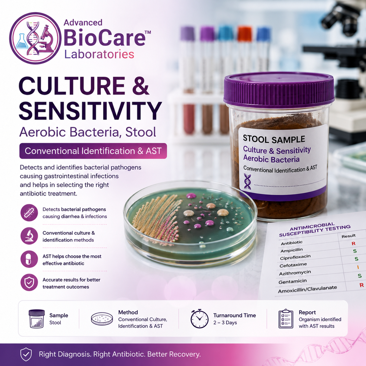 Culture & Sensitivity, Aerobic bacteria, Stool, Conventional Identification & AST