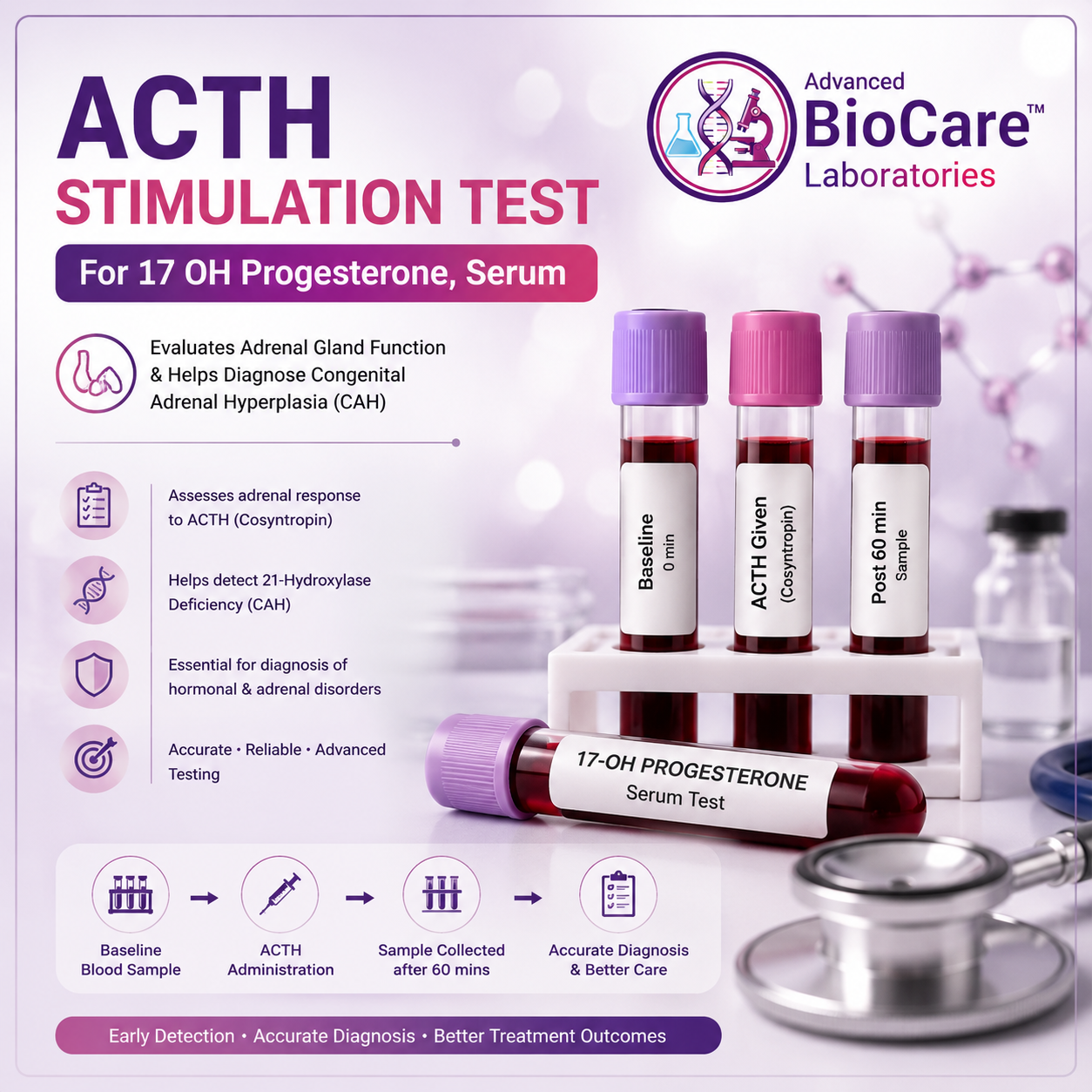 ACTH Stimulation Test - For 17 OH progesterone, Serum