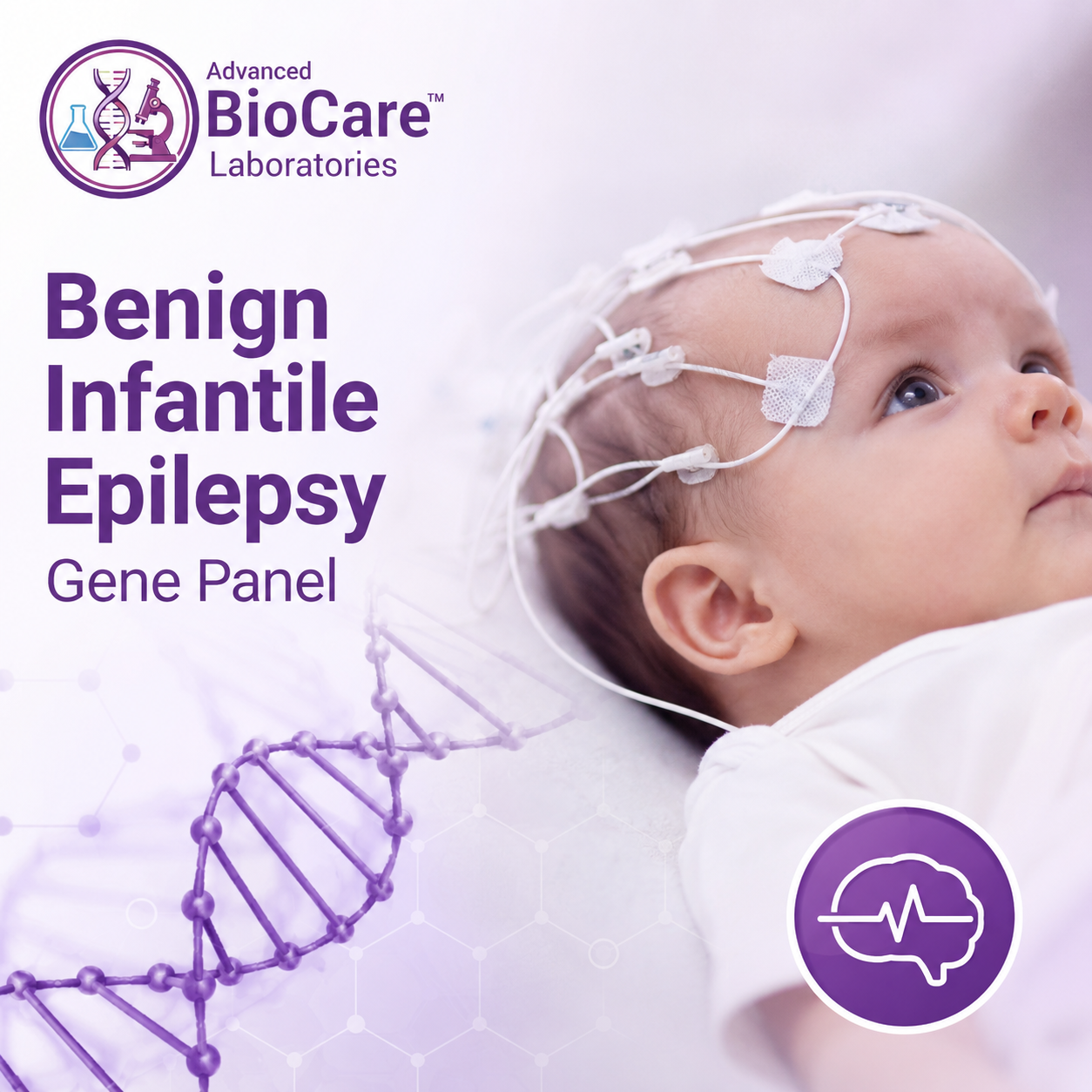 Benign infantile epilepsy gene panel