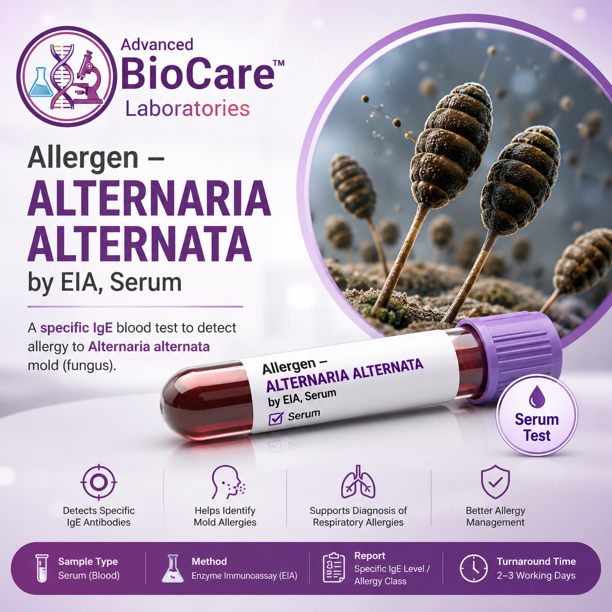 Allergen - ALTERNARIA ALTERNATA by EIA, Serum