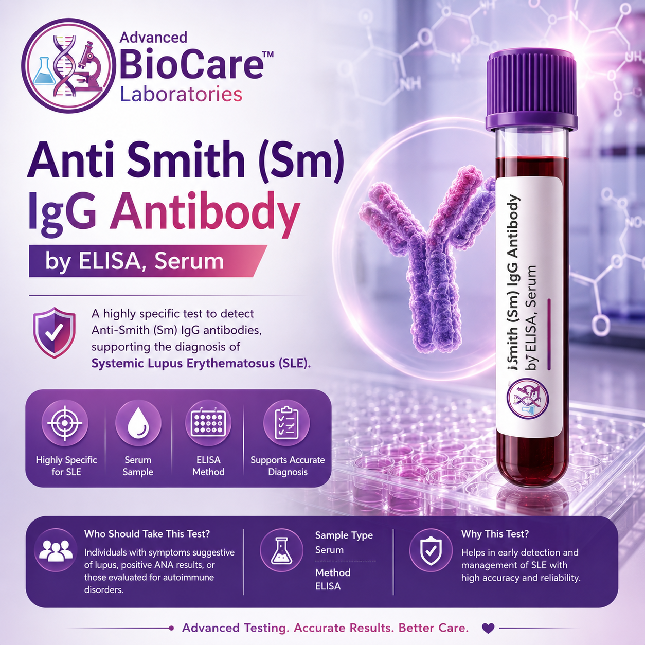 Anti Smith IgG Antibody by ELISA, Serum