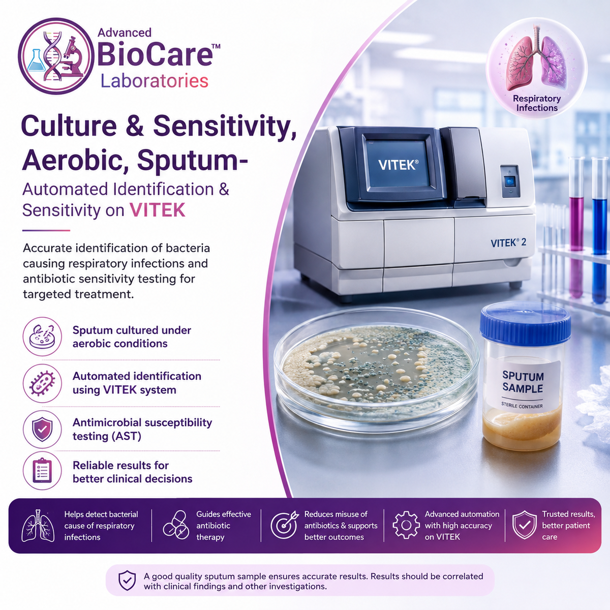 Culture & Sensitivity, Aerobic, Sputum- Automated Identification & Sensitivity on Vitek