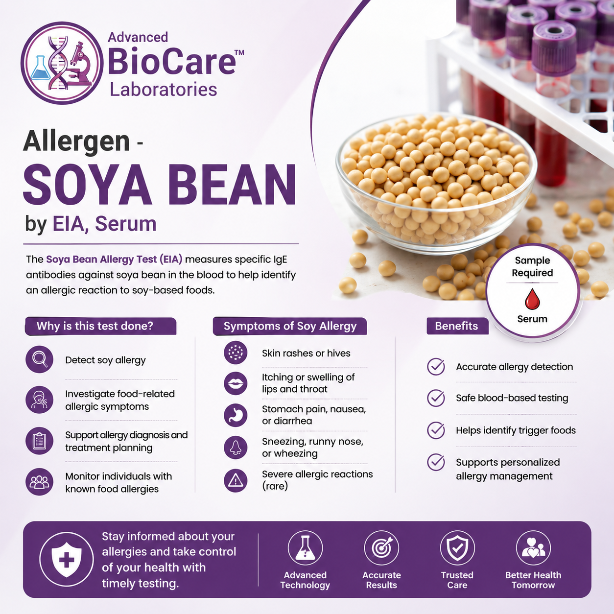 Allergen - SOYA BEAN by EIA, Serum