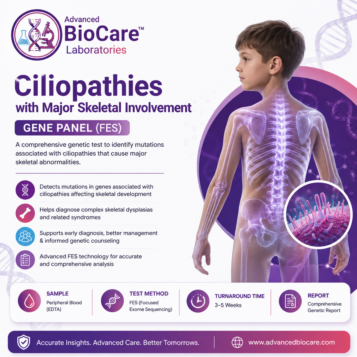 Ciliopathies with major skeletal involvement gene panel (FES)